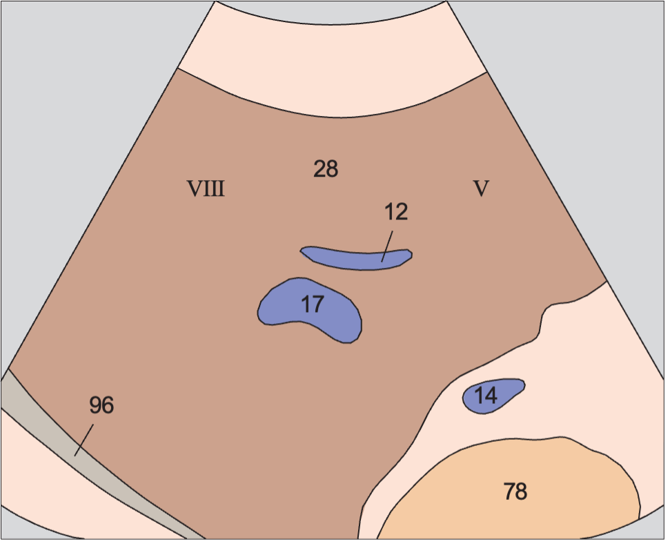 Anterior segment, subsegments VIII and V