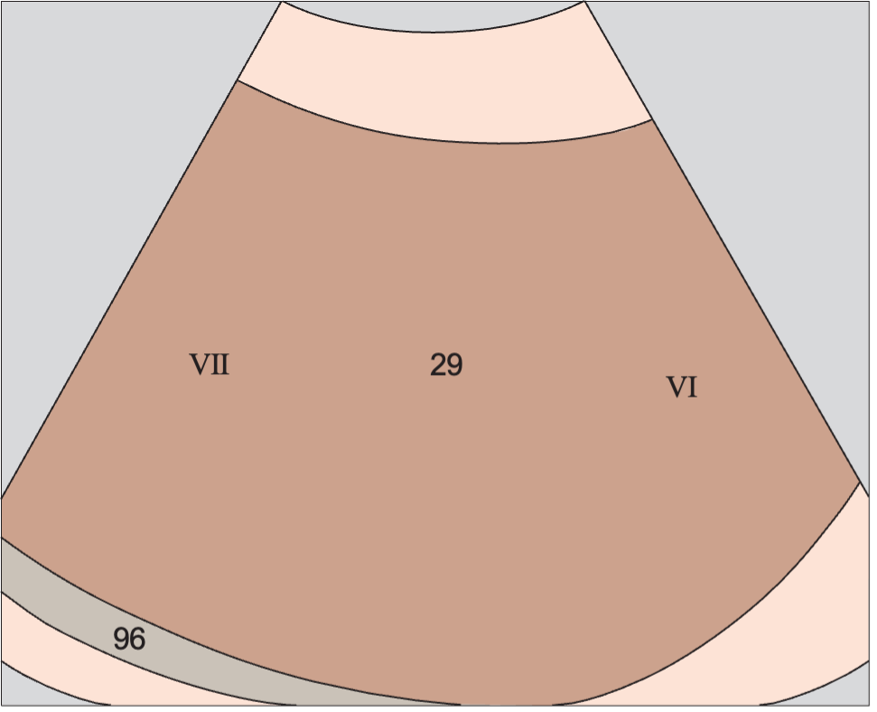 Posterior segment, subsegments VII and VI