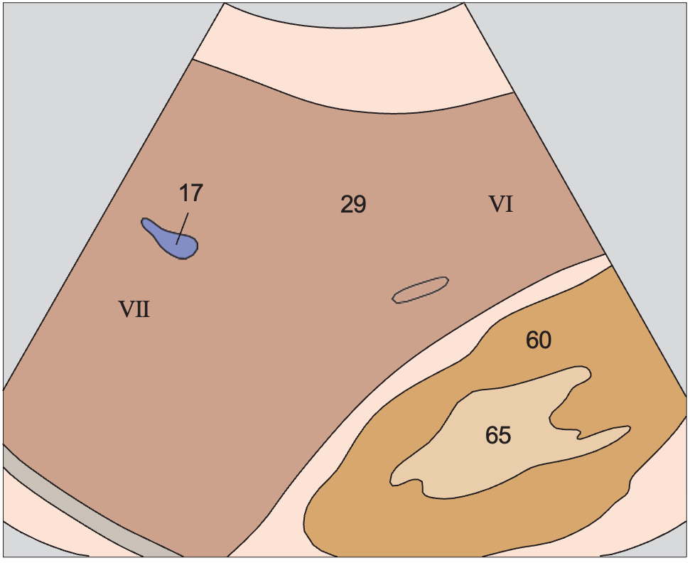 Posterior segment, lateral portions of liver, kidney