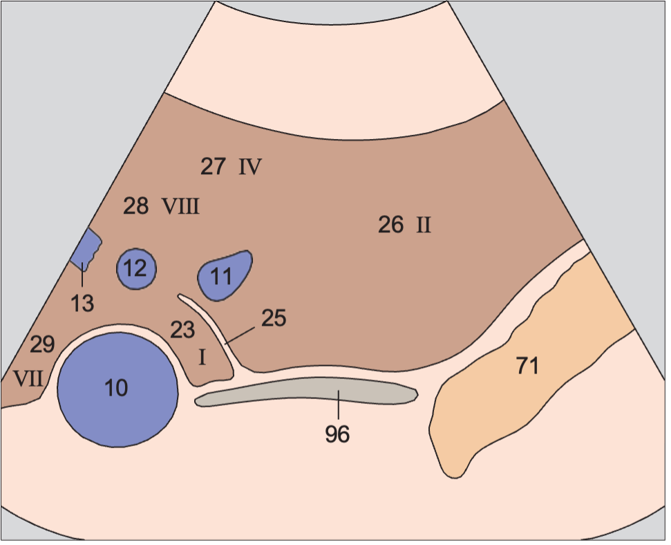 Left lobe of liver, lateral segment, hepatic veins