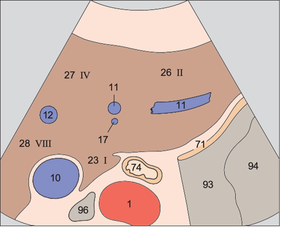 Left lobe of liver, lateral segment, caudate lobe