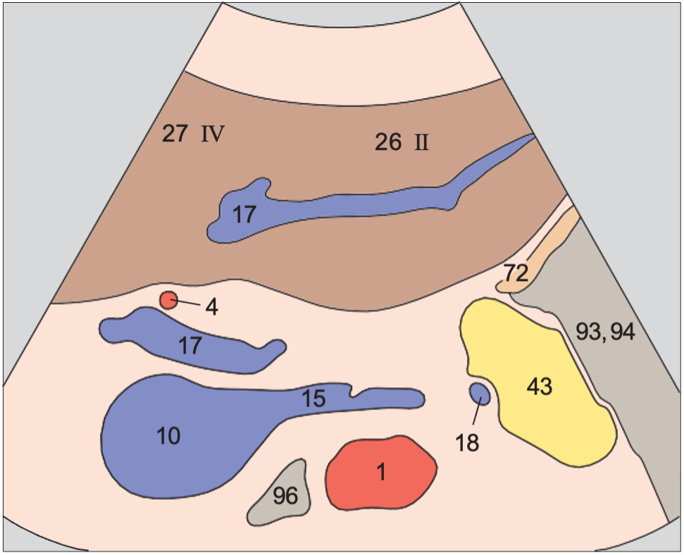 Left lobe of liver, lateral segment, left portal vein branch