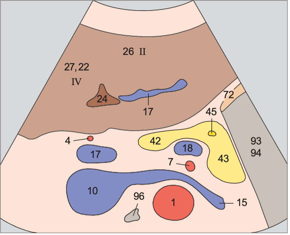 Left lobe of liver, lateral segment, ligamentum teres