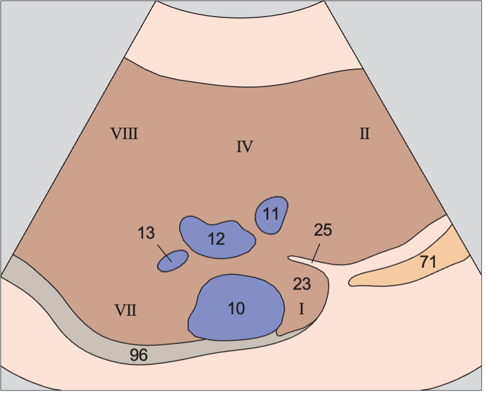 Medial and anterior hepatic segments, hepatic veins, caudate lobe