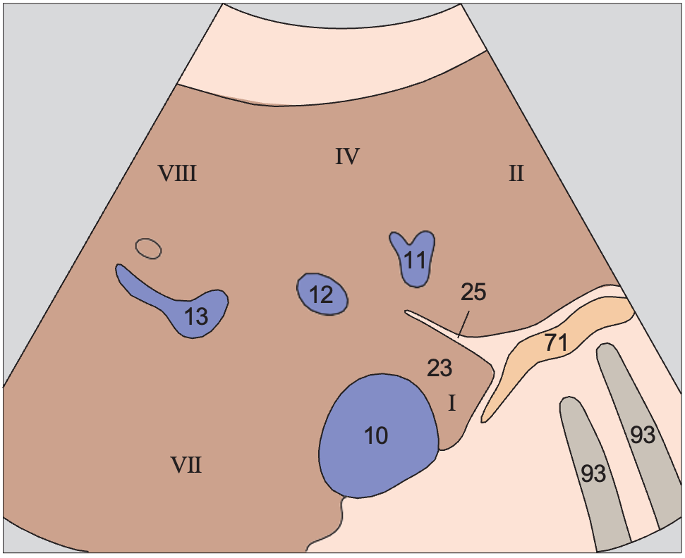 Medial and anterior hepatic segments, hepatic veins, caudate lobe