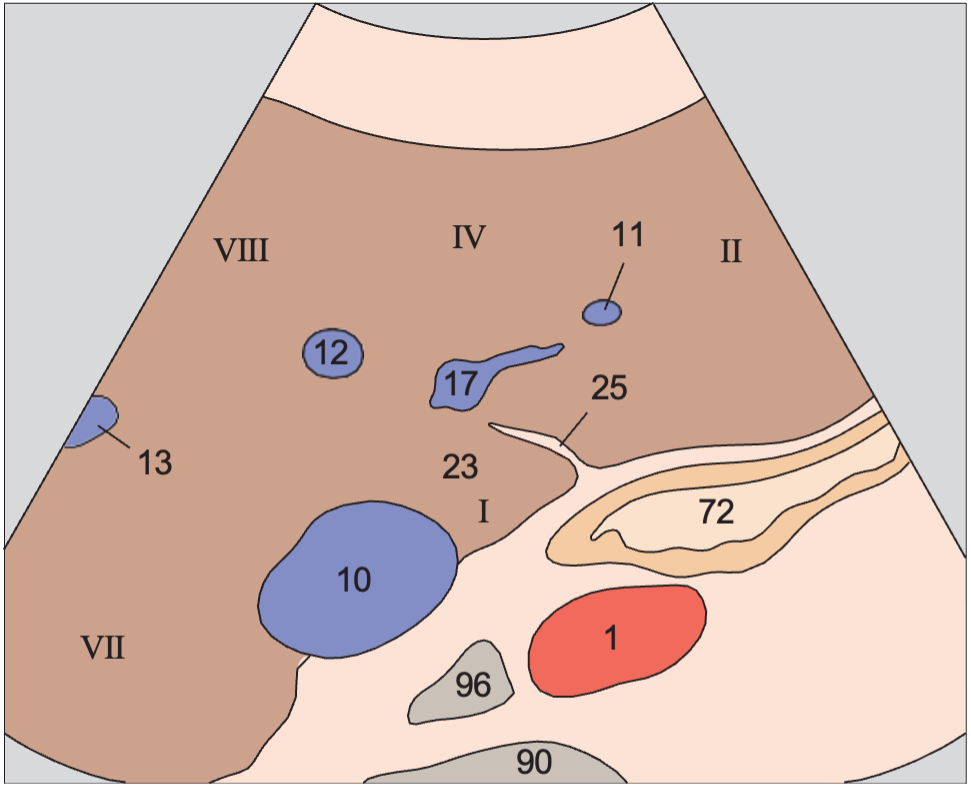 Medial and anterior hepatic segments, left portal vein branch, caudate lobe