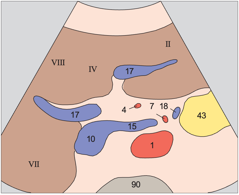 Medial and anterior hepatic segments, right and left portal vein branches
