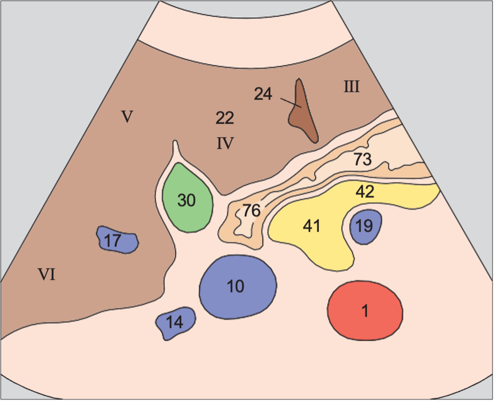 Medial and anterior hepatic segments, quadrate lobe, ligamentum teres, gallbladder