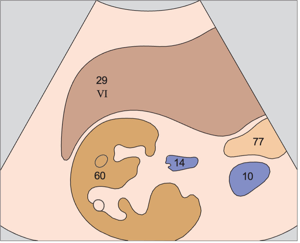 Posterior segment, caudal subsegment, kidney