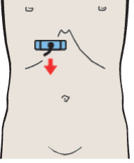 Right portal vein branch, ligamentum venosum
