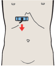 Gallbladder neck