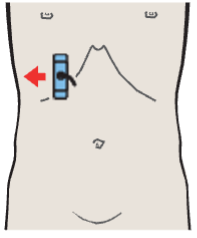 Right portal vein branch, duodenum, gallbladder body