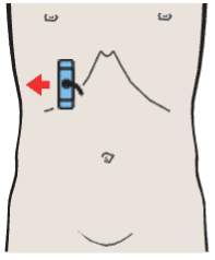 Body and fundus of gallbladder, kidney