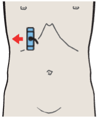 Gallbladder fundus, kidney