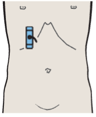 Regions of the gallbladder, spiral folds