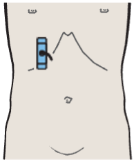 Layers of the gallbladder wall
