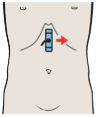 Body of pancreas, splenic vein, superior mesenteric artery, aorta