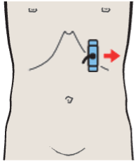 Tail of pancreas, splenic artery and vein, renal artery and vein