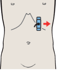 Tail of pancreas, splenic artery and vein, renal artery and vein