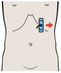 Tail of pancreas