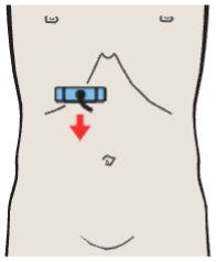 Head of pancreas, vena cava, superior mesenteric vein