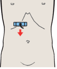Head of pancreas, vena cava, superior mesenteric vein, uncinate process, common bile duct