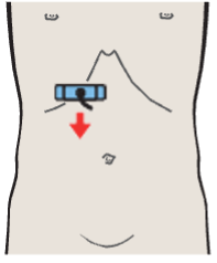 Head of pancreas, vena cava, superior mesenteric vein, uncinate process, gallbladder
