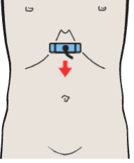 Scan cranial to body of pancreas, celiac trunk