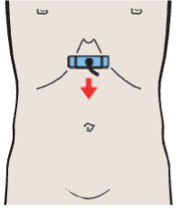 Left renal artery and vein, superior mesenteric artery and vein, aorta