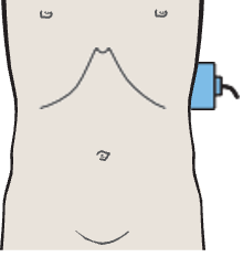 Spleen, kidney