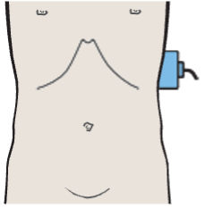 Splenic hilum, splenic vein