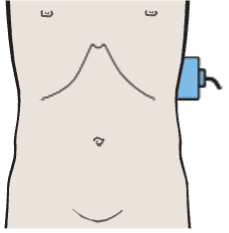 Spleen, stomach