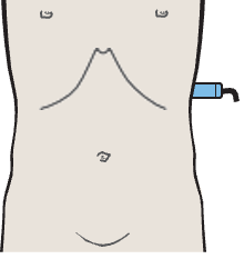 Spleen, kidney, stomach