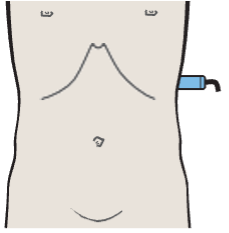 Spleen, kidney, pancreas