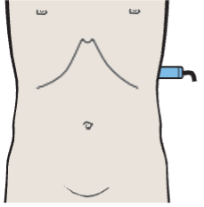 Spleen, small bowel