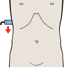 Kidney, liver, psoas muscle, quadratus lumborum muscle