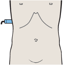 Kidney, liver, psoas muscle, quadratus lumborum muscle