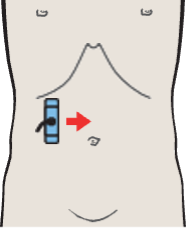 Kidney, liver