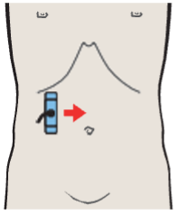 Kidney, liver, colic flexure