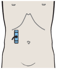 Kidney, renal vein, colon