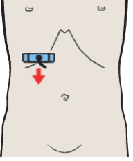 Kidney, renal vein, vena cava, liver
