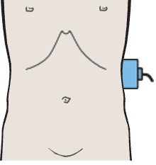 Kidney, spleen, psoas muscle