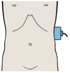 Kidney, renal vein, spleen, aorta