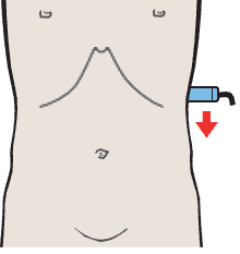 Kidney, spleen, bowel