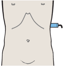 Kidney, spleen, psoas muscle