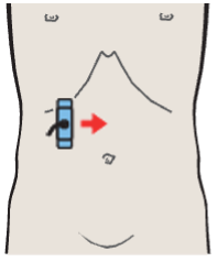 Kidney, liver