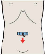 Confluence of iliac veins
