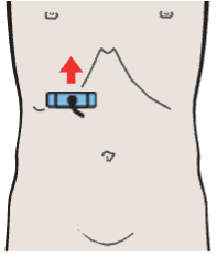 Kidney, renal vein, vena cava