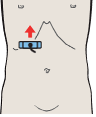 Renal vein, vena cava