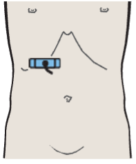 Adrenal gland, vena cava